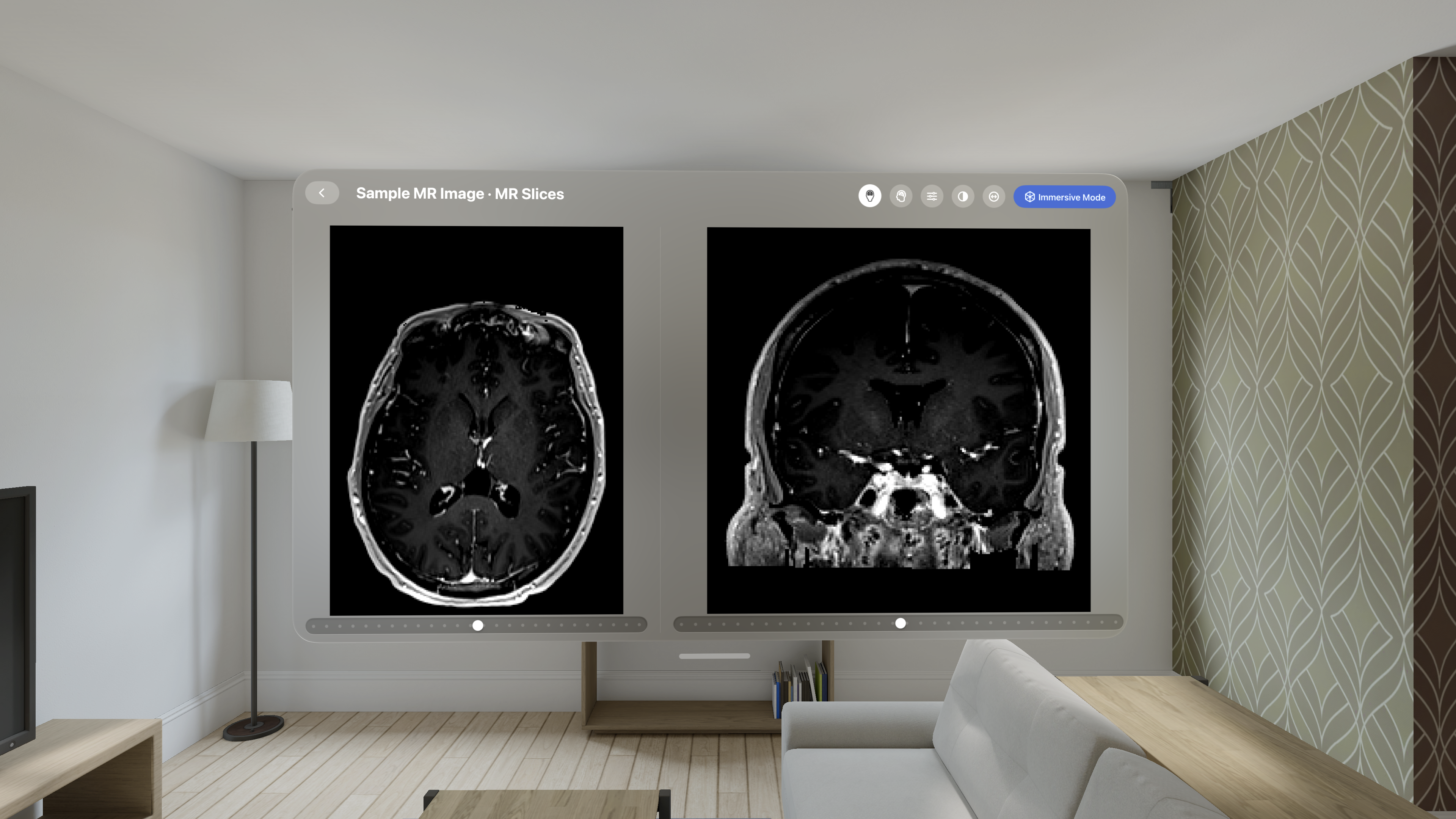 MR brain imaging