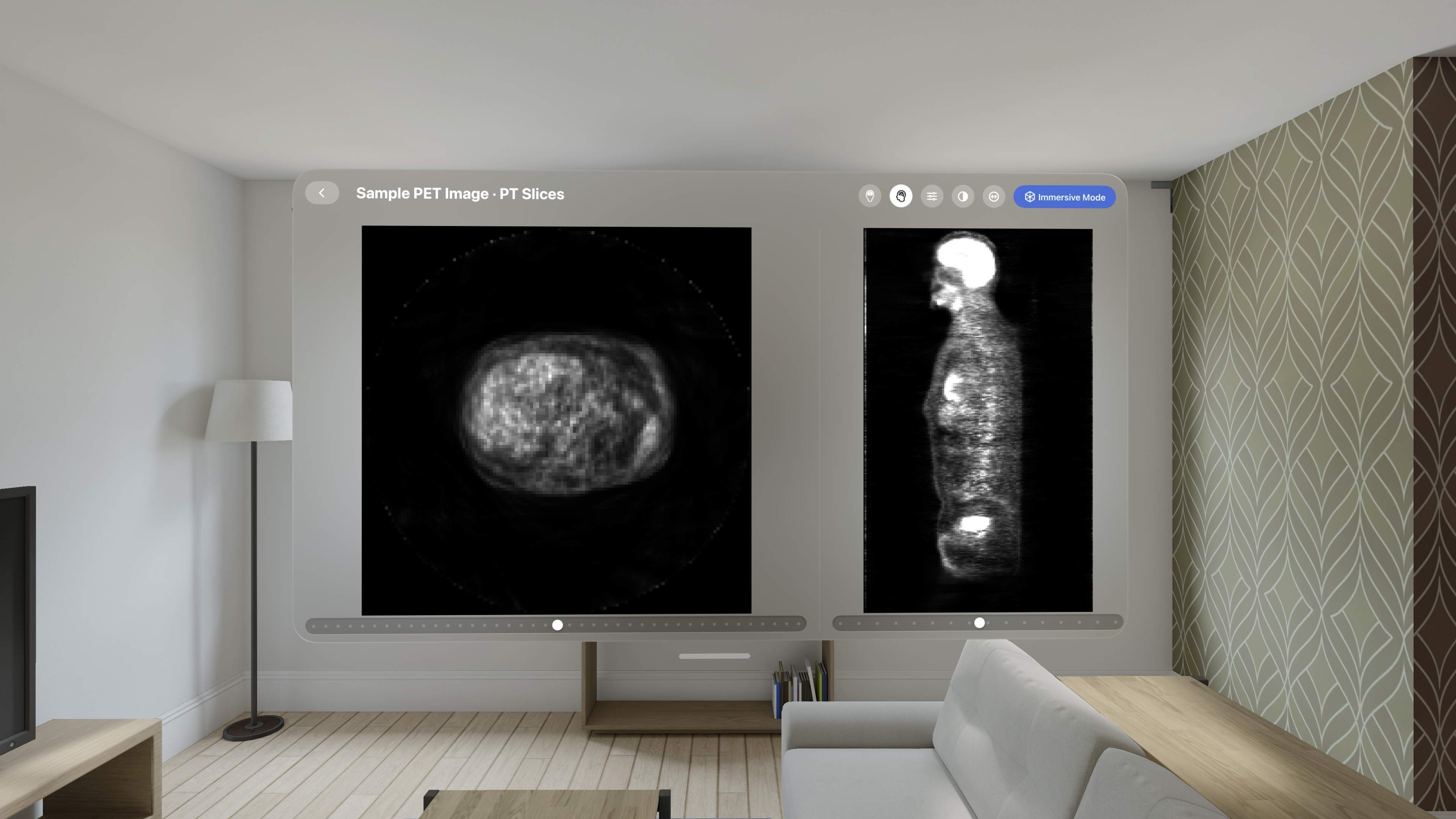 PET whole-body imaging